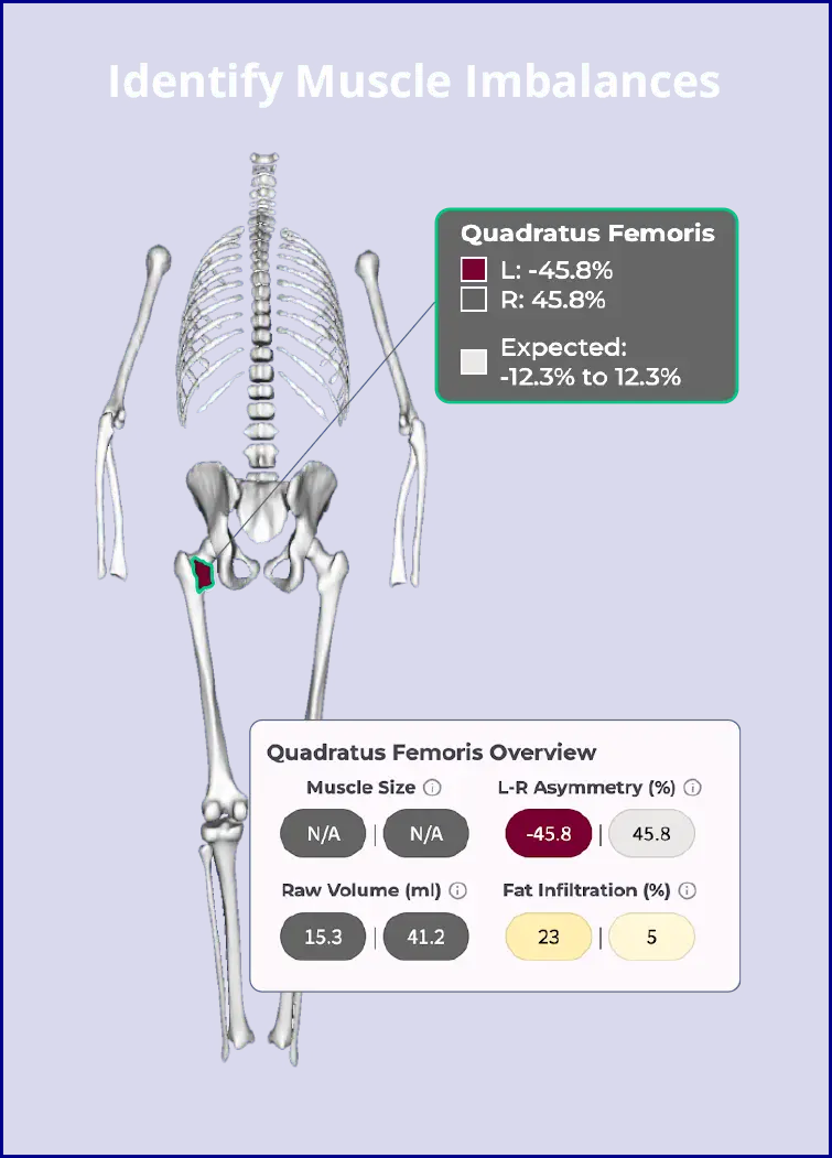 Identify Muscle Imbalances